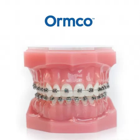 Hệ thống mắc cài Damon “Giải pháp chỉnh nha cải tiến hàng đầu đến từ Mỹ”